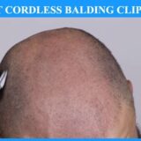 best cordless hair clippers for bald head