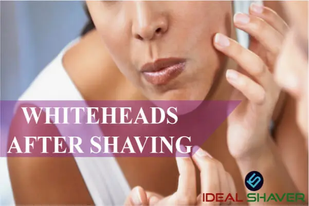 after shaving whiteheads