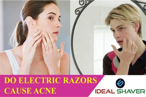 do electric razors cause acne